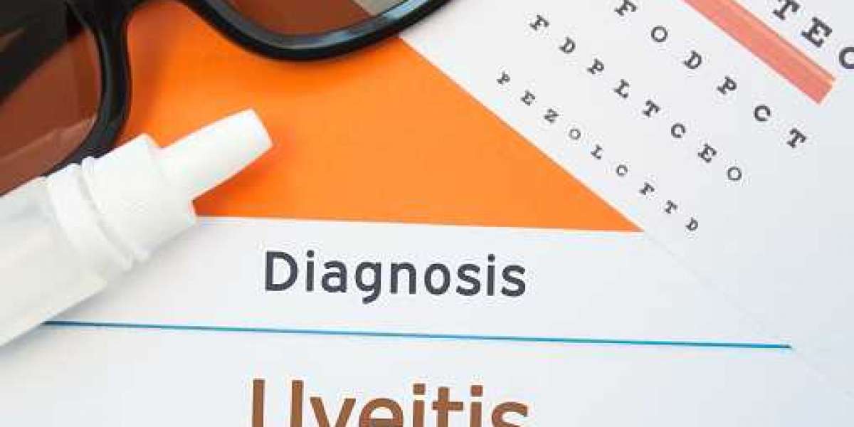 Uveitis Market Report 2020: Top Players Countries Type and Application Regional Forecast To 2030